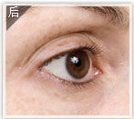 藝星塑美極 揭秘定格逆齡術，告別塑料網眼袋